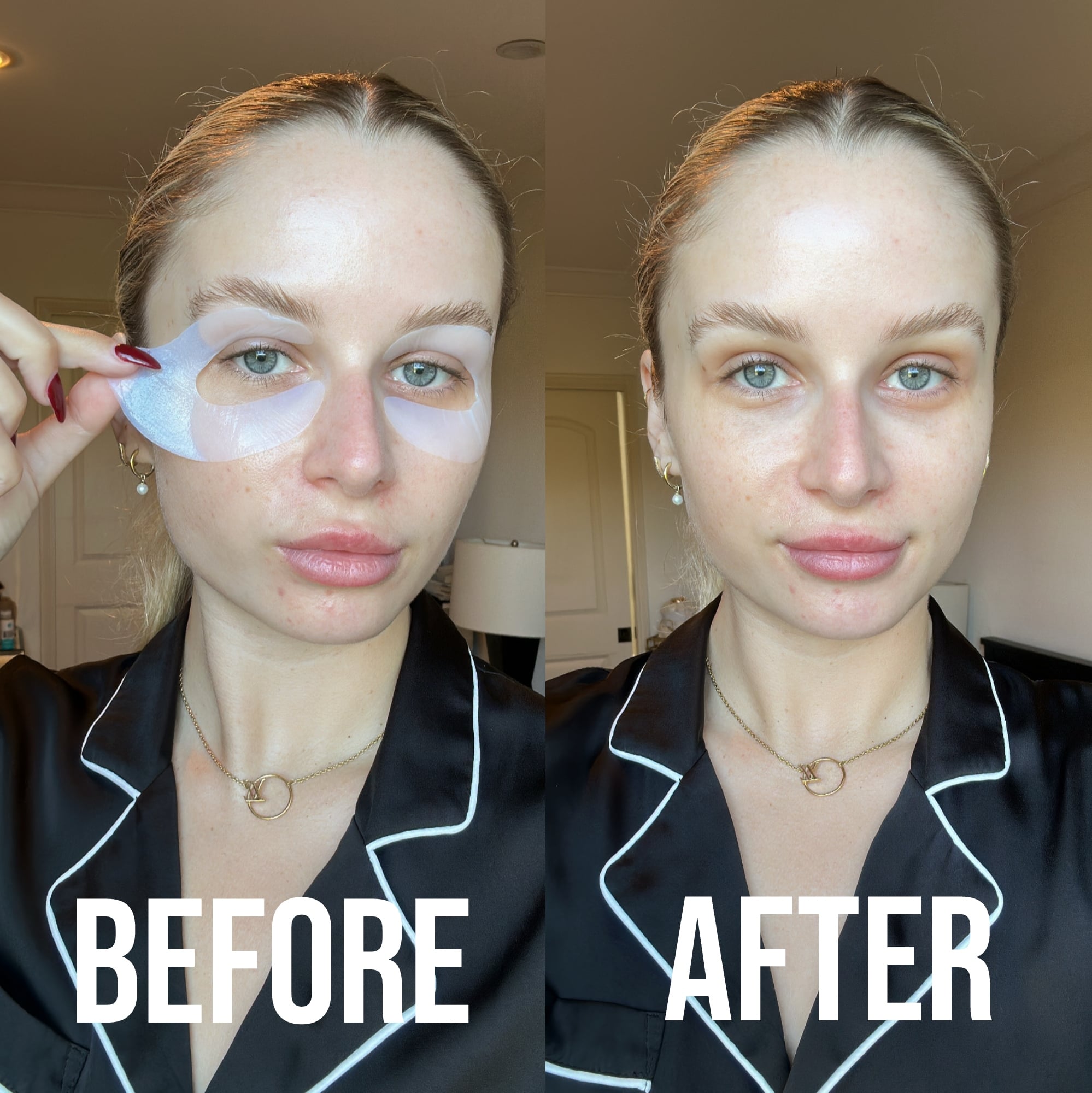 Taylor Before and After Wearing Peace Out Retinol Eye Lift Patches