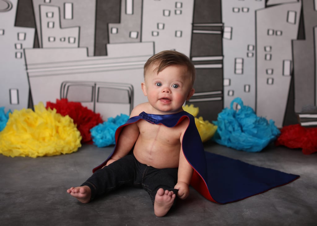 Baby With Down Syndrome Celebrates Birthday With Cake Smash
