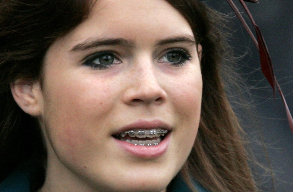 Princess Eugenie flashed her royal braces in 2006.