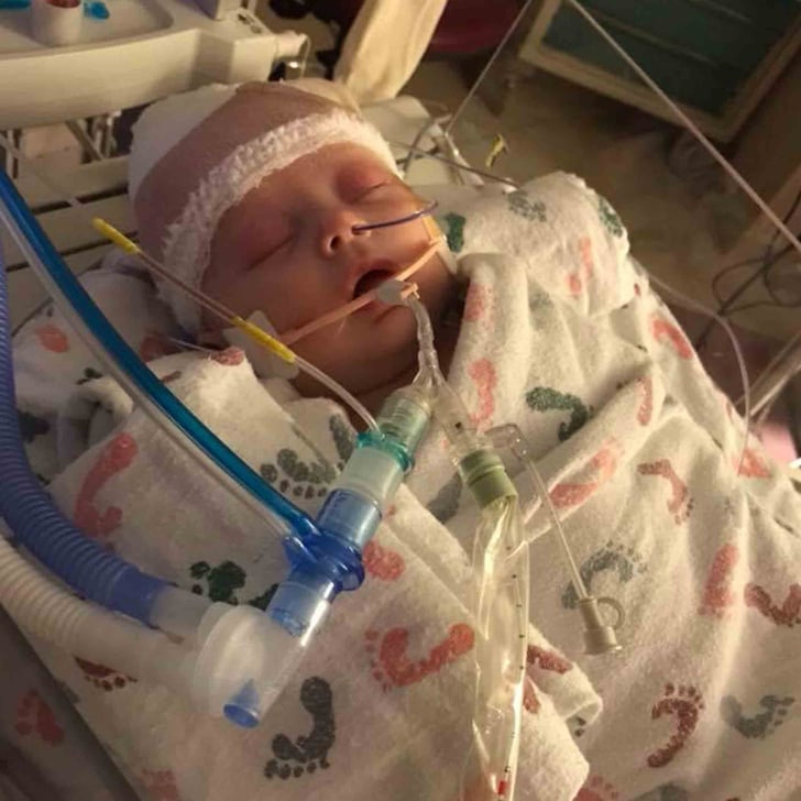 Baby Gets Hit in the Head With a Softball POPSUGAR Moms