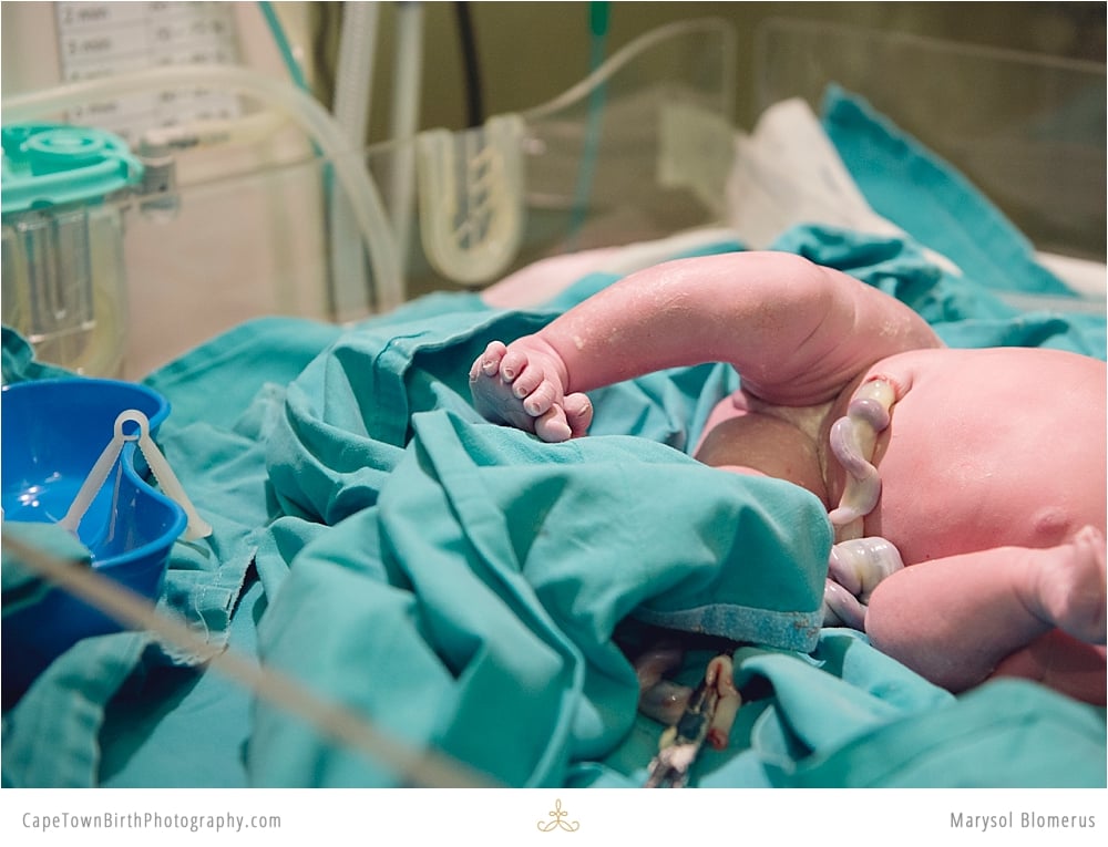 C-Section Birth For Blended Family in South Africa