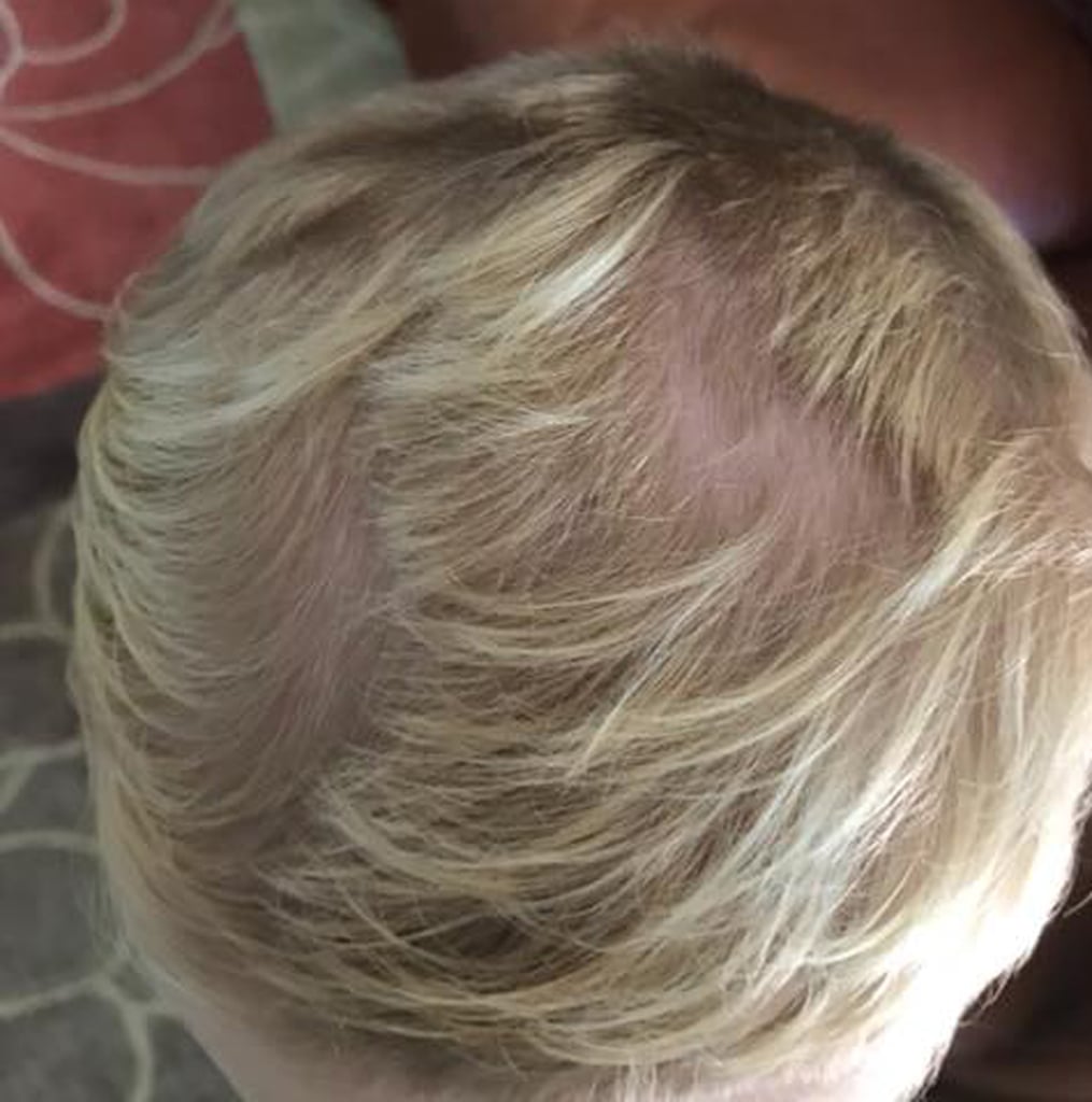 Cameron's Hair