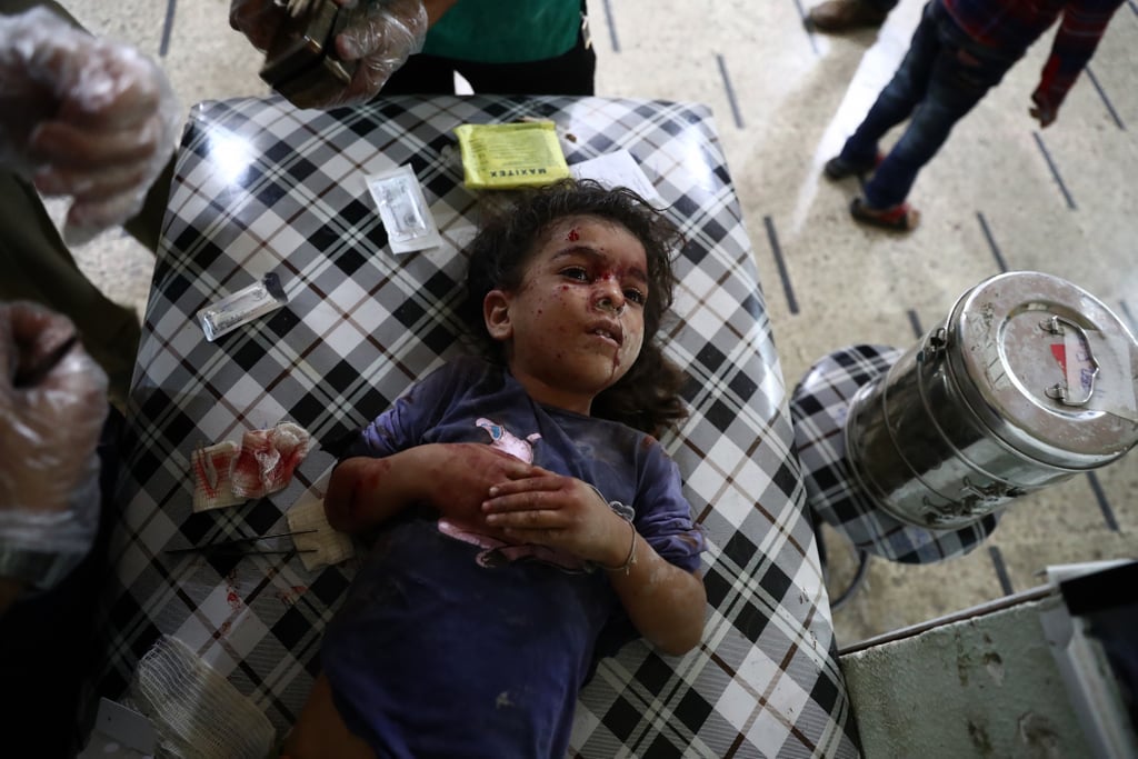 A child is treated after an airstrike in Douma, just outside the capital.
