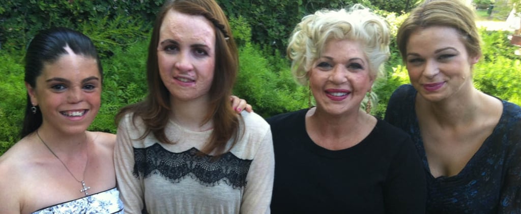Burn Survivor Holds Angel Faces Retreat | Video