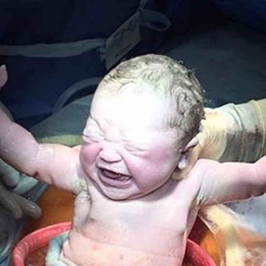 C-Section Birth Photo