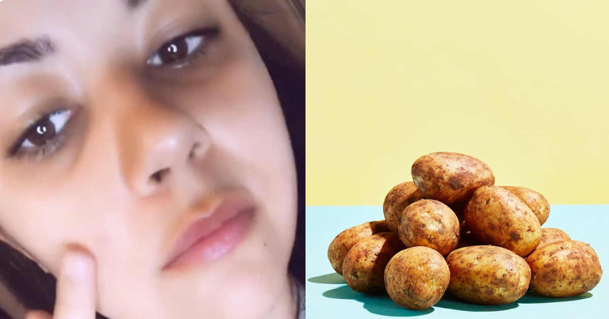 Raw Potato On Pimple Treatment Does The Hack Work Popsugar Beauty