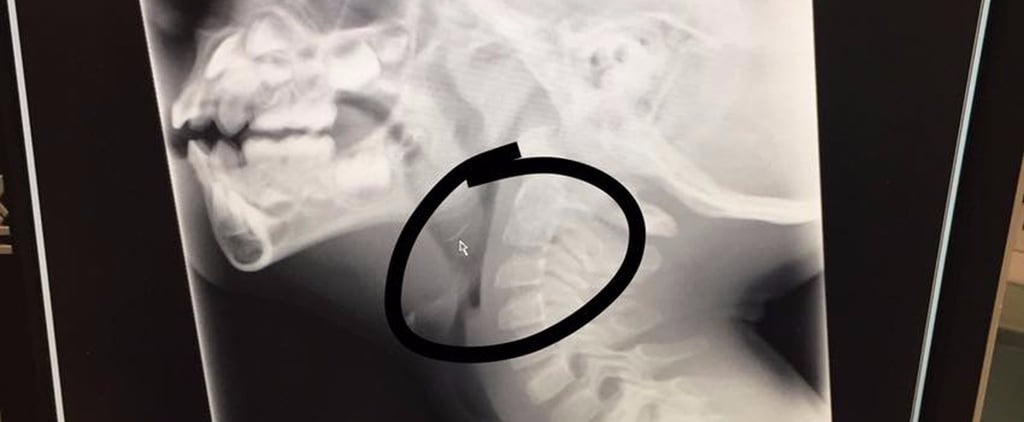 Why Metal Grill Brushes Are Dangerous