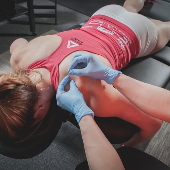 What Is Dry Needling? Is It Safe?