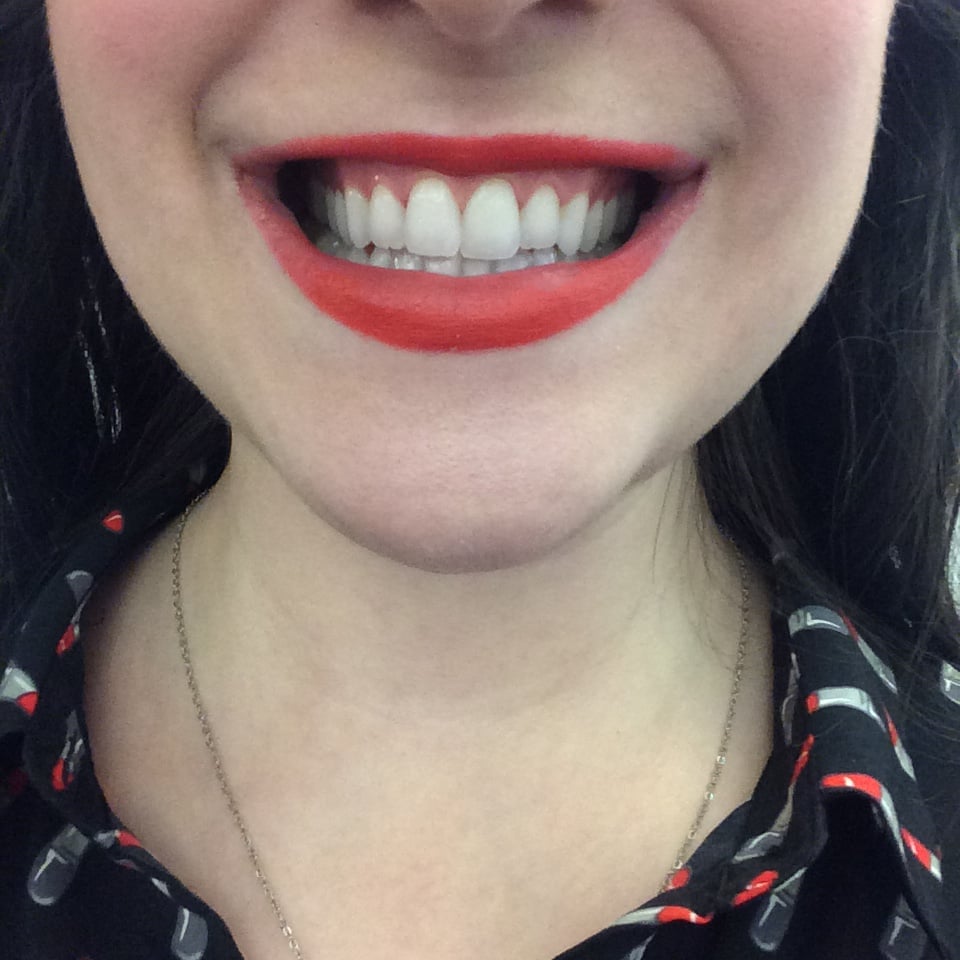 After Using the Popwhite Color-Correcting System