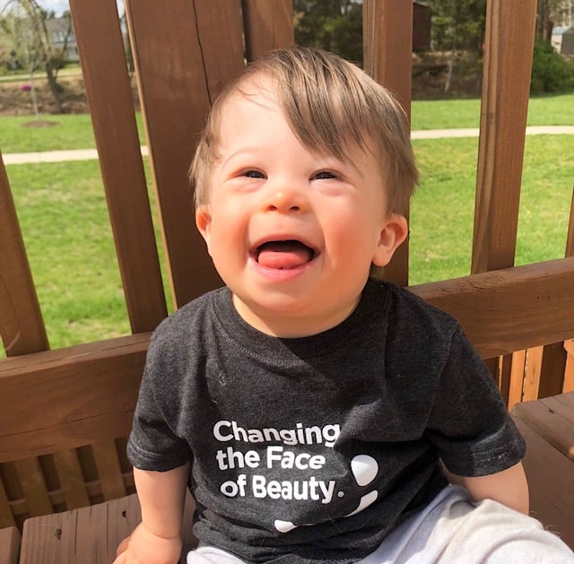 Photos of Babies With Down Syndrome