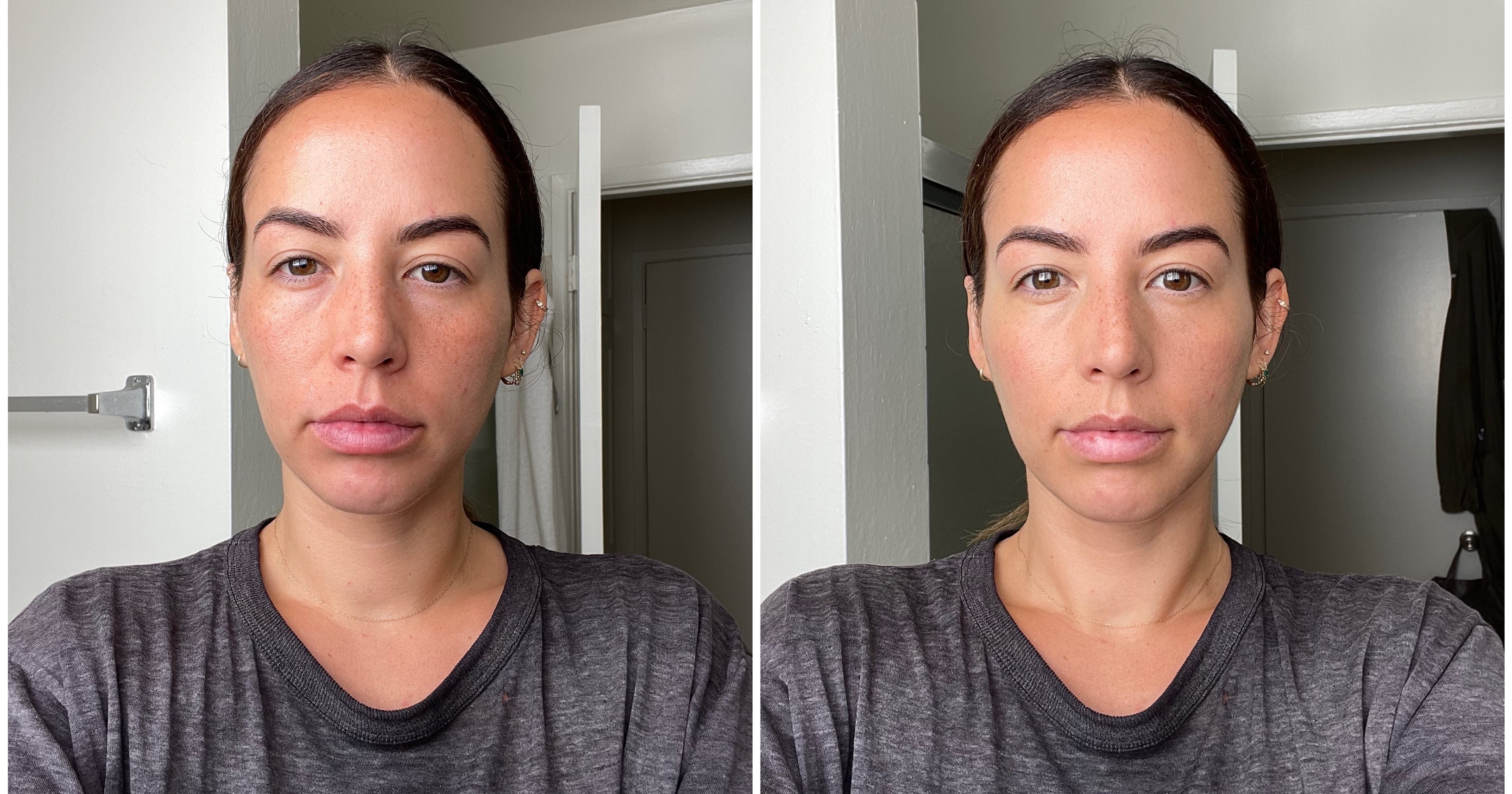 I Tried using the 3-Dot Concealer Hack: See Photos