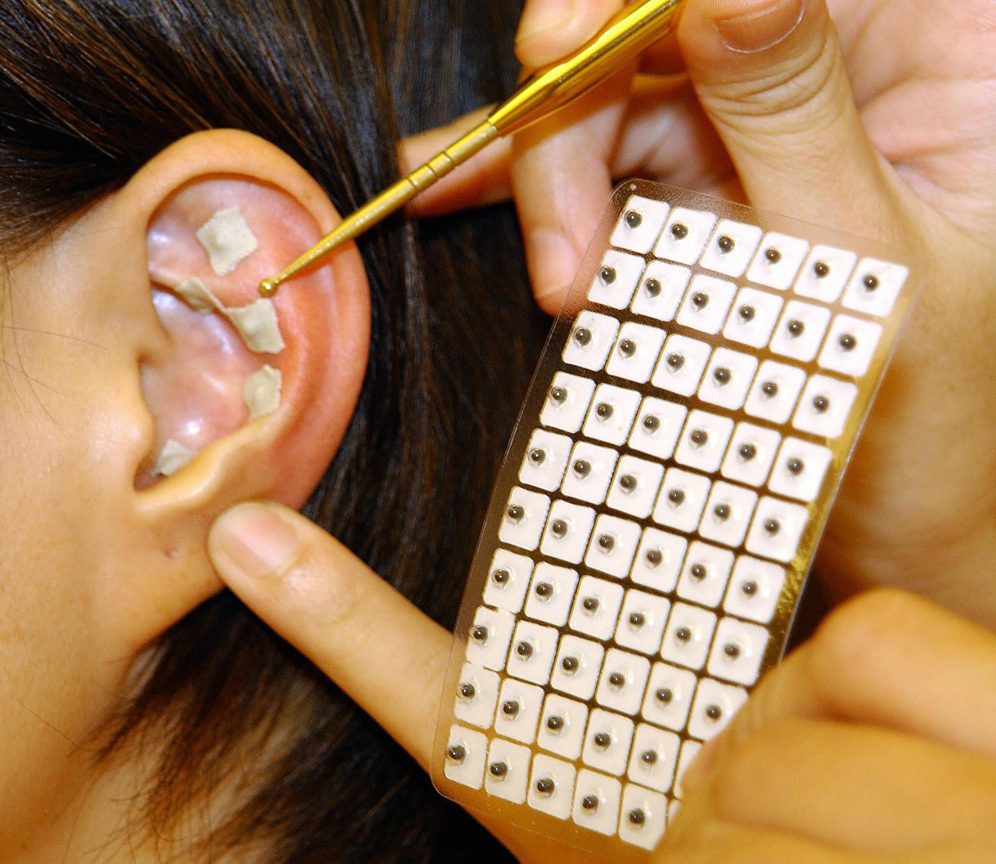 Liu Chi-feng, chairman of Health Promotion Association in Taiwan, demonstrates 19 September 2003 ways of taping Wang Pu Liu Hsing seeds over points on a person's ear at an anti-AIDS seminar sponsored by Taiwan's Center for Disease Control.  Liu, who practices traditional Chinese medicine, said pressing the points several times a day would enforce a person's immunity.  AFP PHOTO/Sam YEH  (Photo credit should read SAM YEH/AFP via Getty Images)