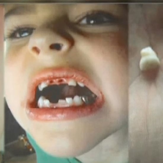 Florida Dentist Abusing Child Patients