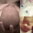 10 Surprisingly Weird Side Effects of Being a Newborn