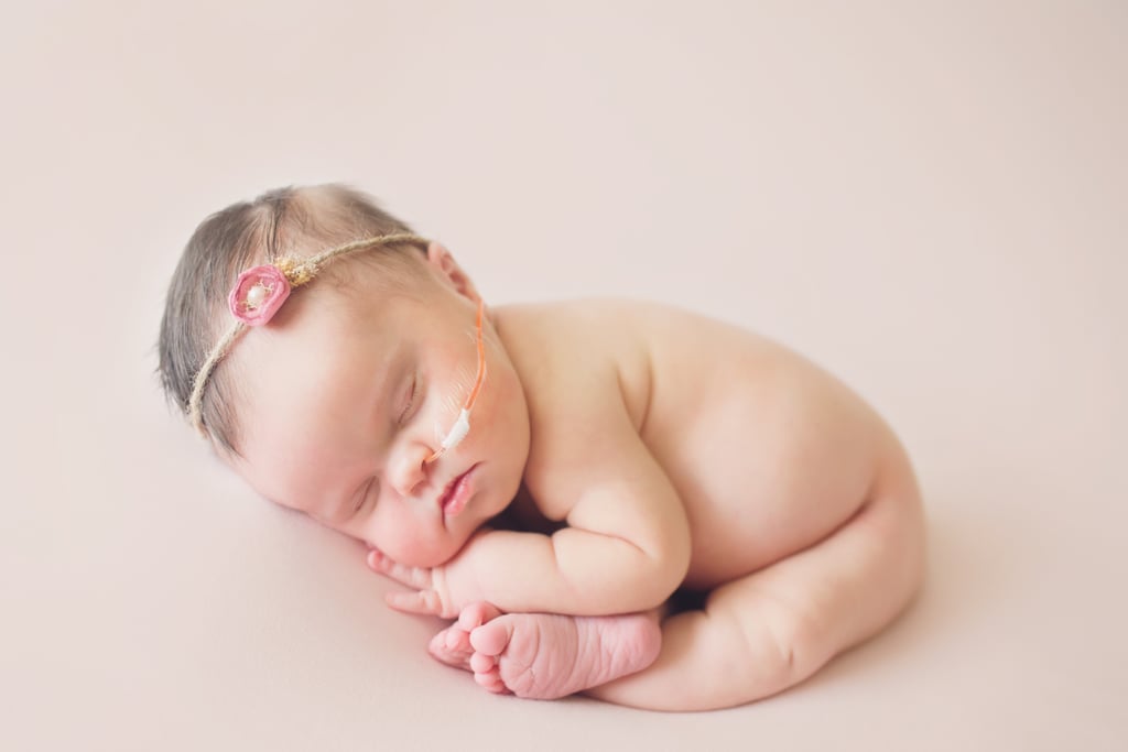 Newborn With Inoperable Tumor in Family Photos