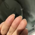 Why You Have Skin Growing Under Your Nails