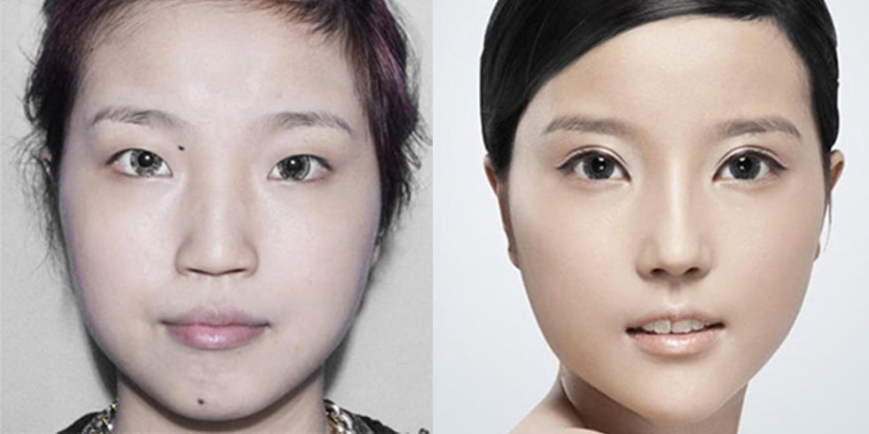 Extreme Plastic Surgery Causes Passport Confusion