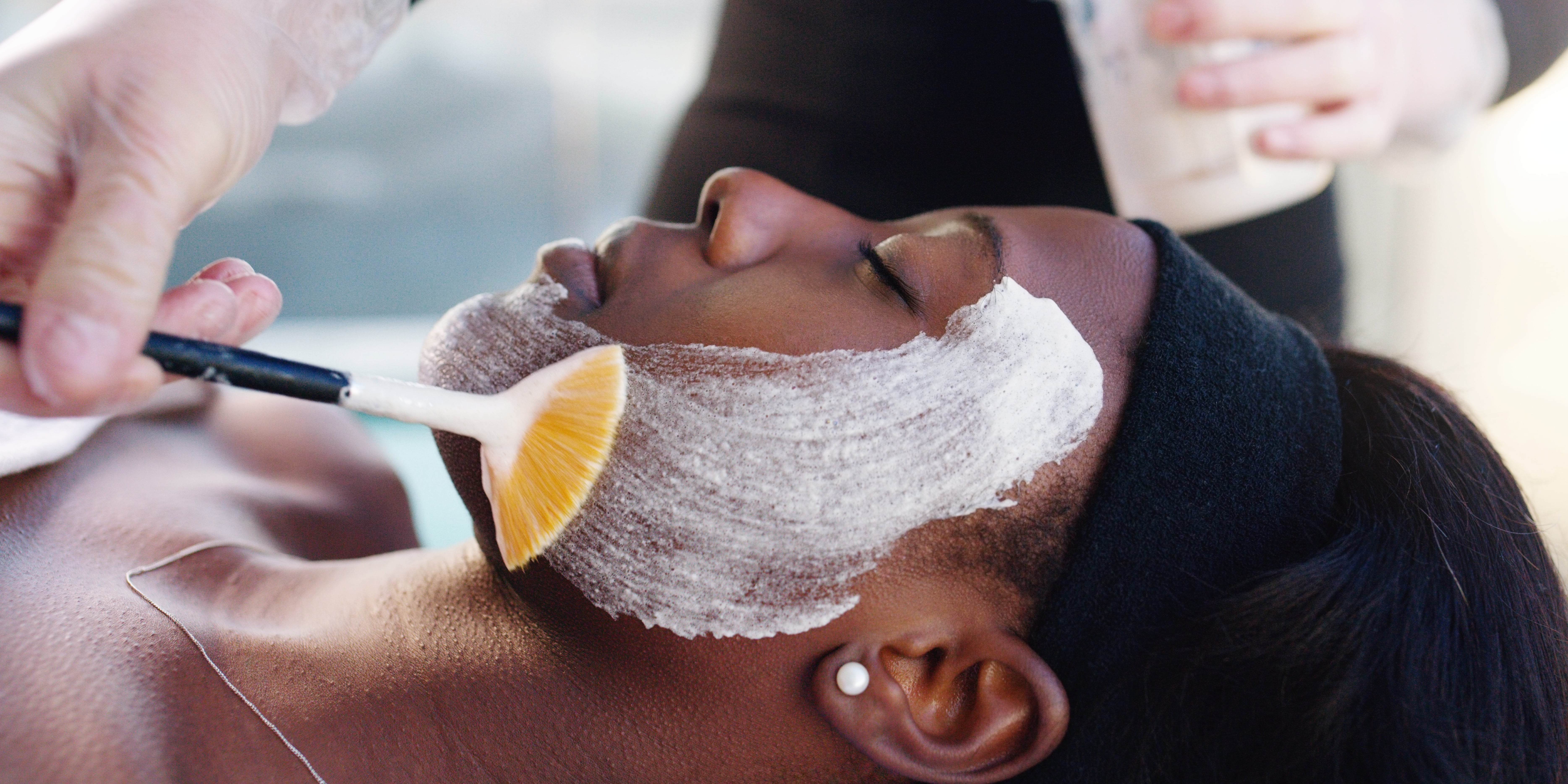 Chemical Peels: Types, Benefits, Aftercare, and More - Vimarsana News