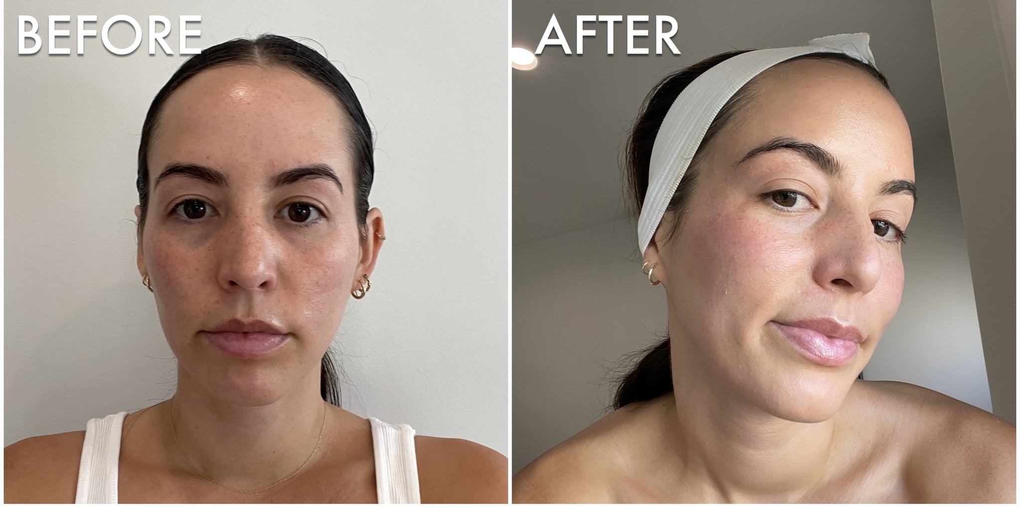 diamondglow facial before and after