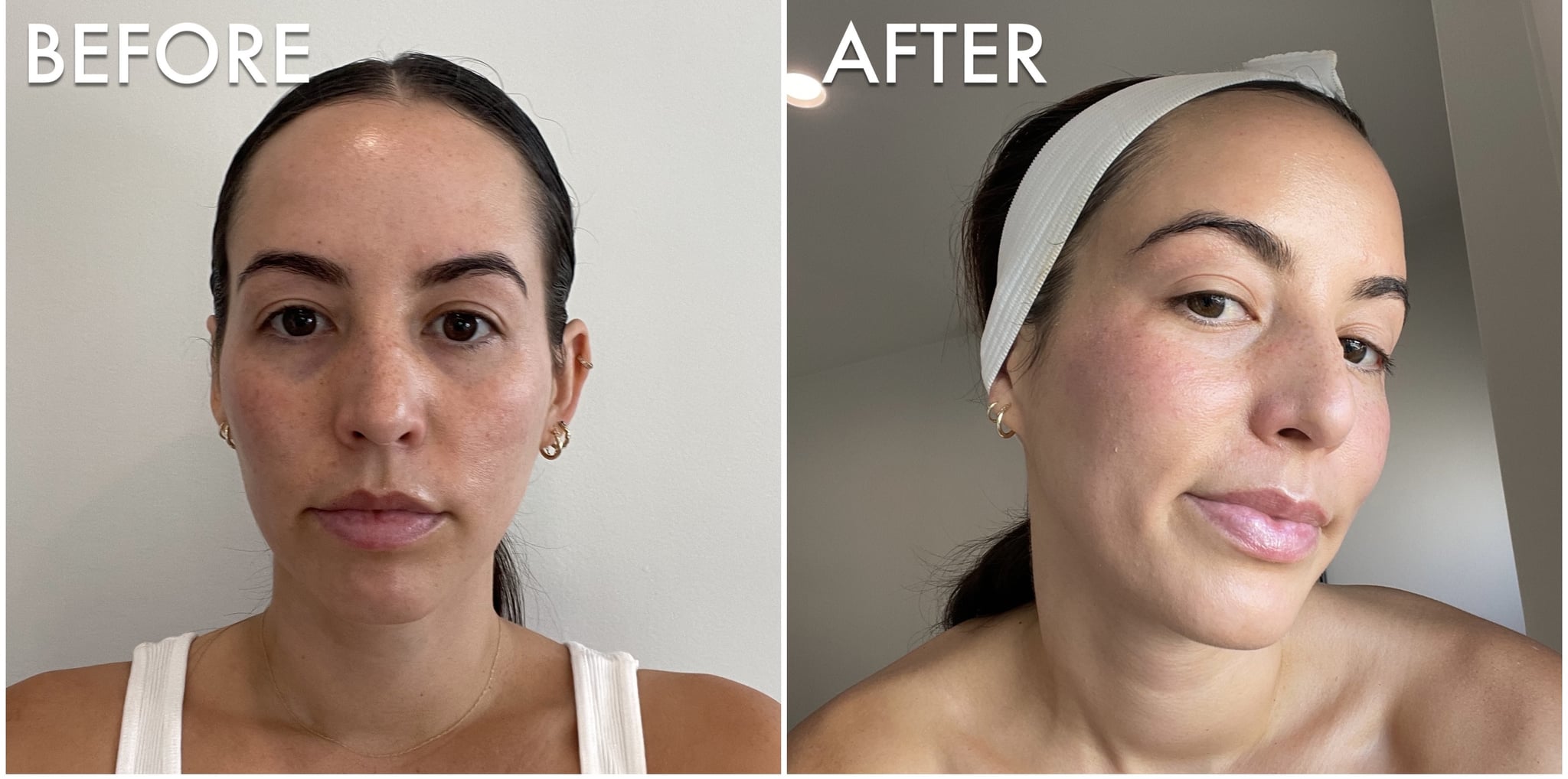 I Tried A 200 Celebloved Facial And My Skin Has Never Looked Better