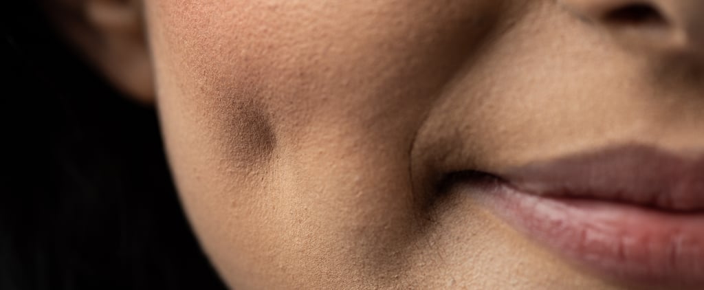 Dimpleplasty Surgery: Cost, Downtime, and Potential Risks
