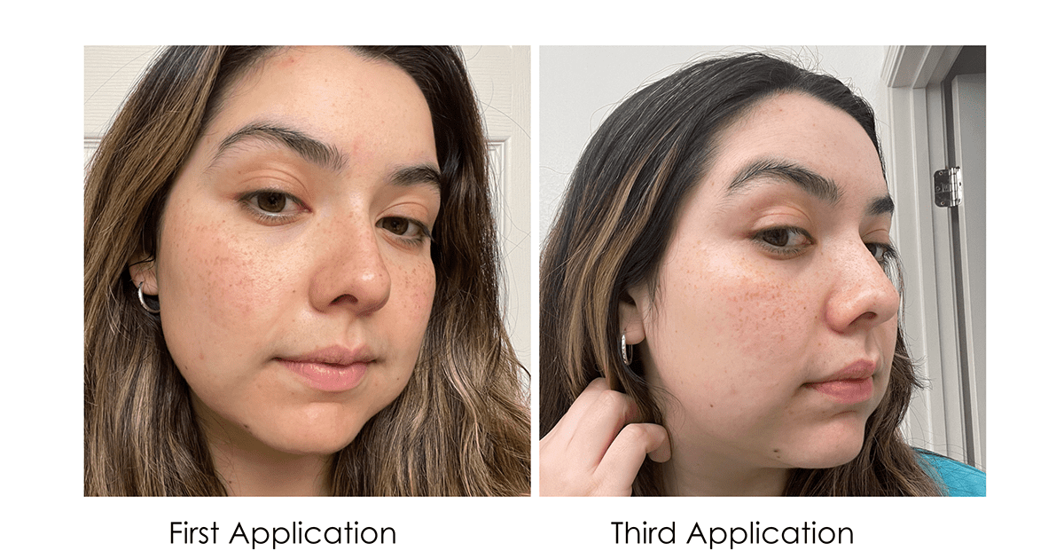 My Skin After Using It the First Time and Third Time in the Same Week
