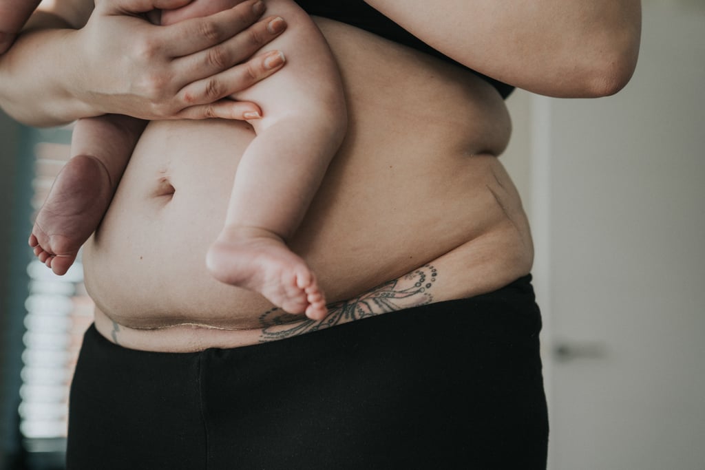 "She was one of the last people to see her little boy, which for a new mother must be totally heartbreaking. For this reason, Jade has had a bit of a love-hate relationship with her scar."
