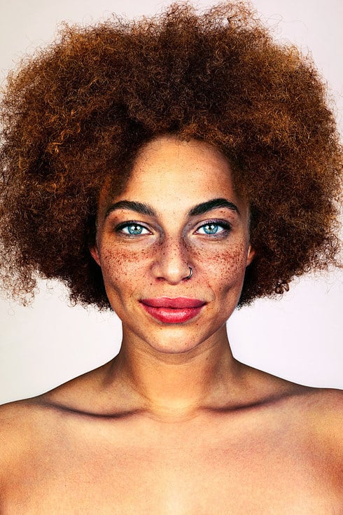 Photos of People With Freckles