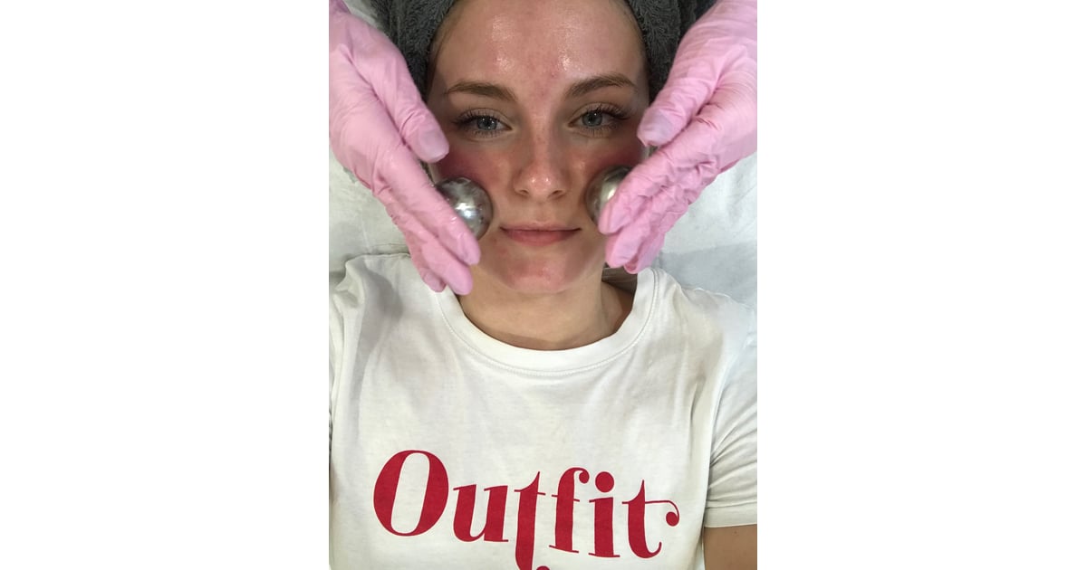 During Treatment How to Treat Broken Capillaries on the Face