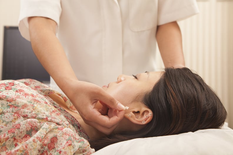 Chinese doctor using acupuncture on patient