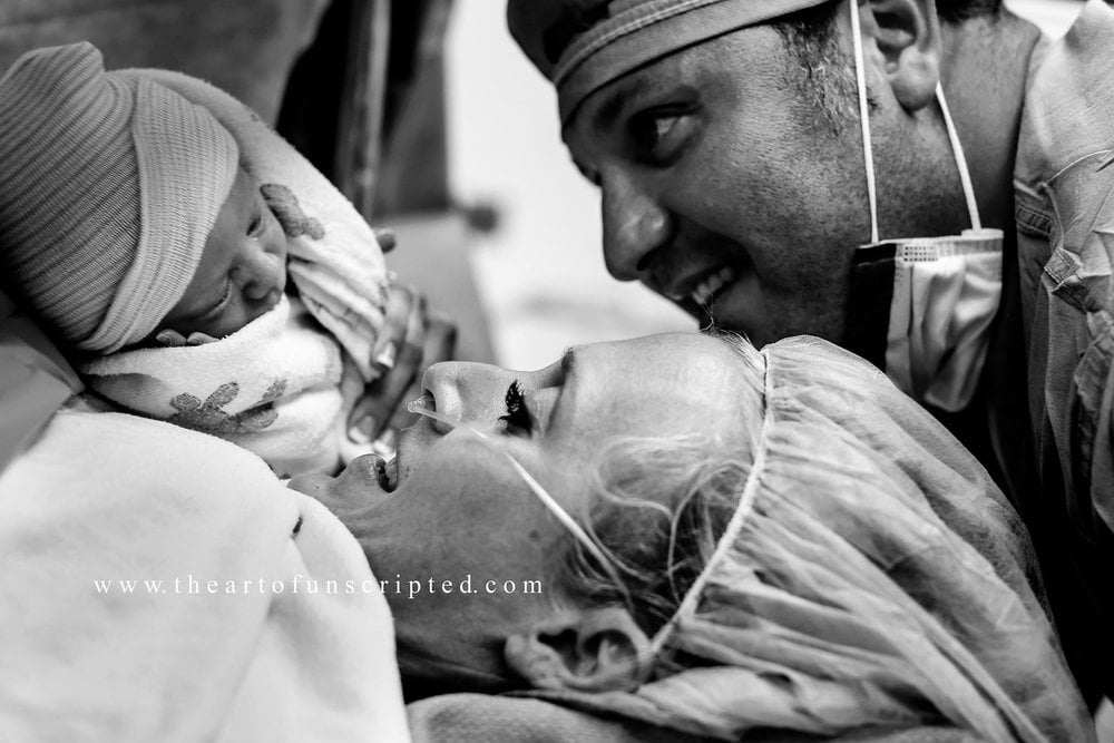 C-Section Birth Photography