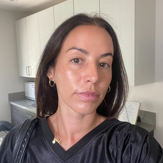 I Tried an Exosome Facial: See Photos