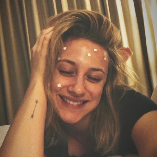 Lili Reinhart Photo of Cystic Acne