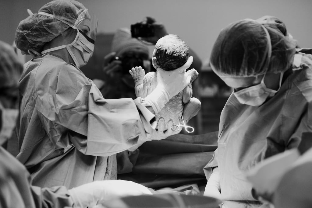 Dramatic C-Section Birth Photos