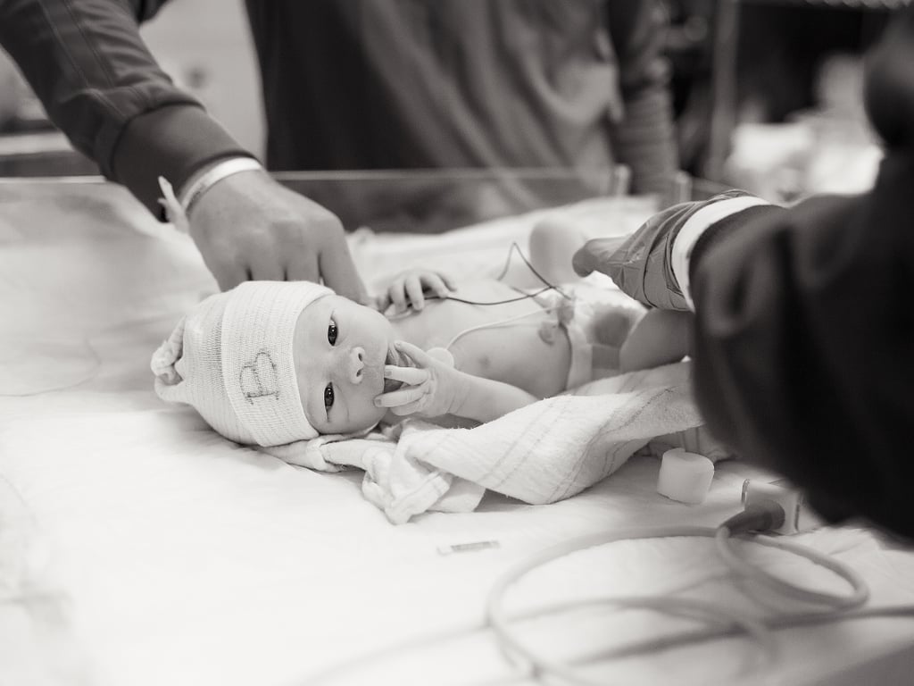 Photographs of Twin Birth