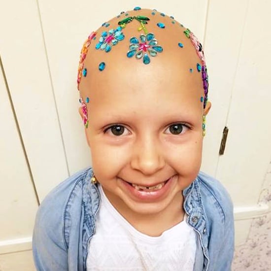 Girl With Alopecia on Crazy Hair Day
