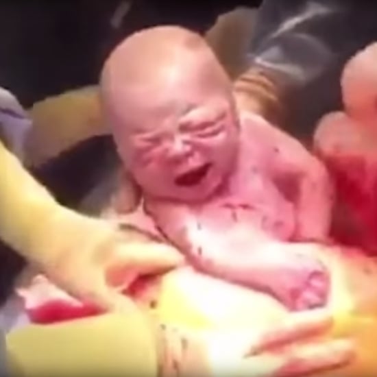 Mom Films Her Own C-Section Birth