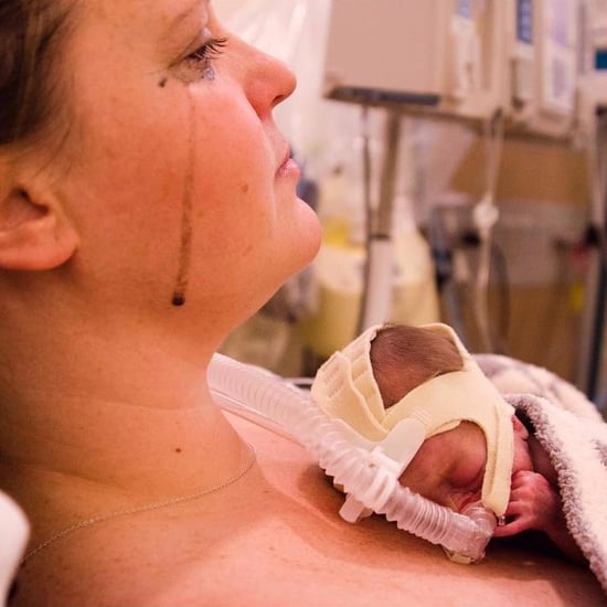 Mom's Post About Scariest Moment in NICU