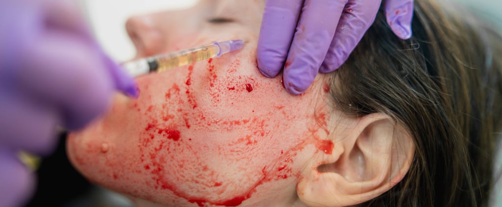 Has the "Vampire Facial" Officially Gone Too Far?