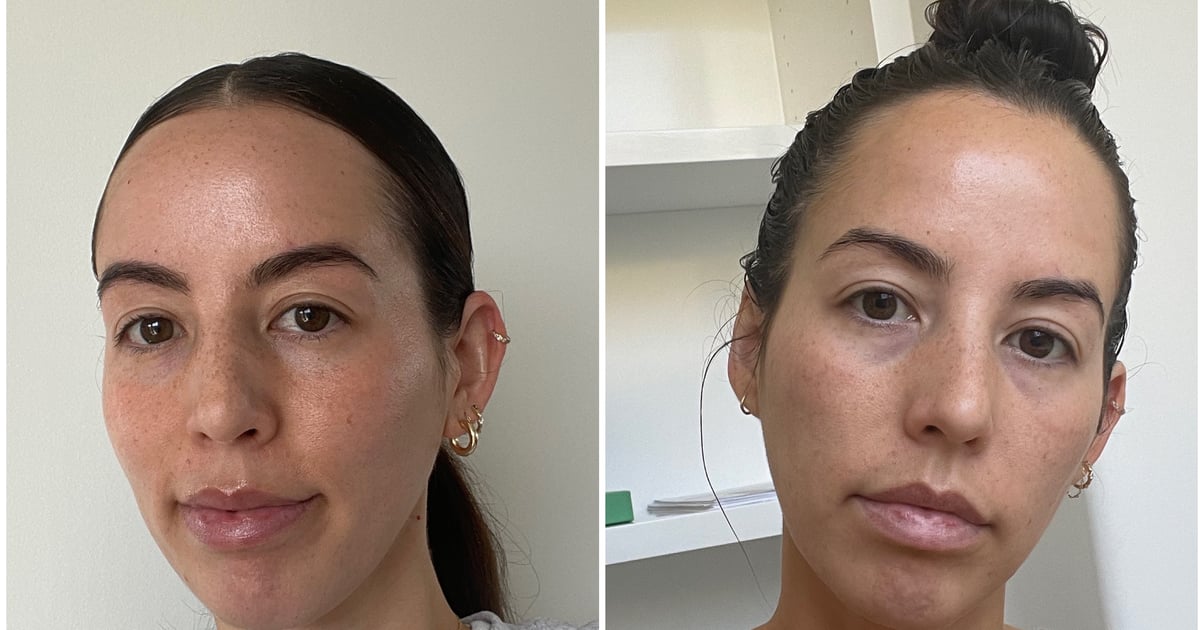I Skipped Skin-Care Products For 7 Days: Editor Experiment