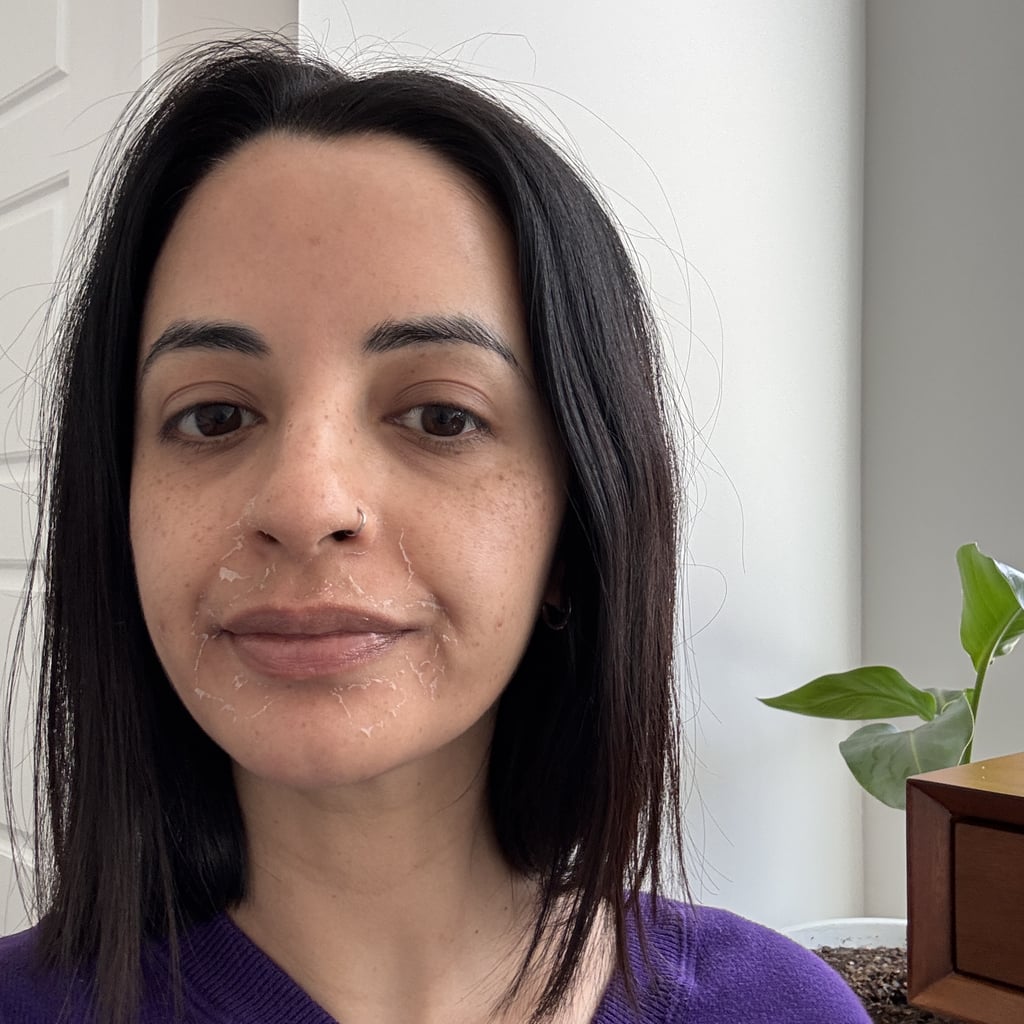 I Tried a Chemical Peel For Acne and Dark Spots — Now, it's My Holy Grail