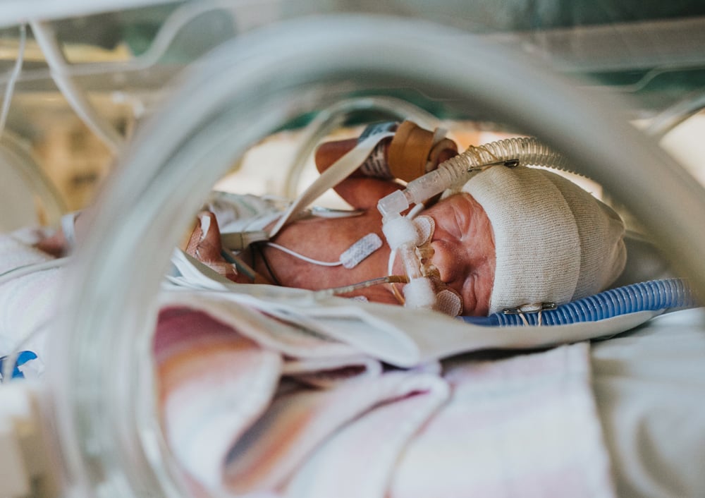 Photos of Premature Baby's Time in the NICU