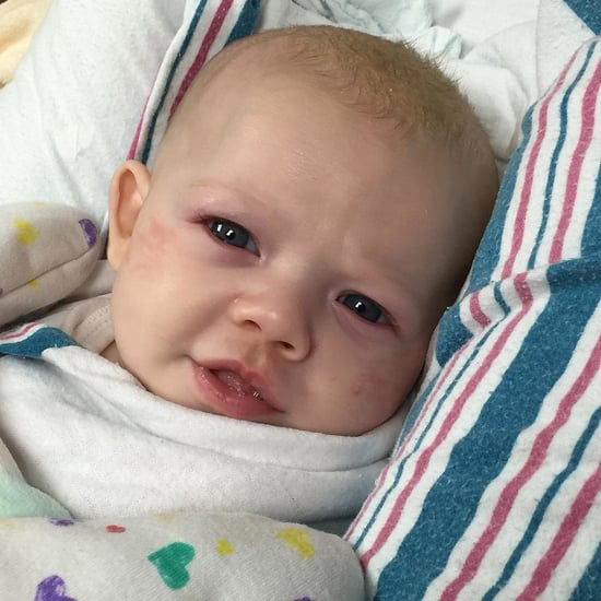 Baby Almost Dies From RSV