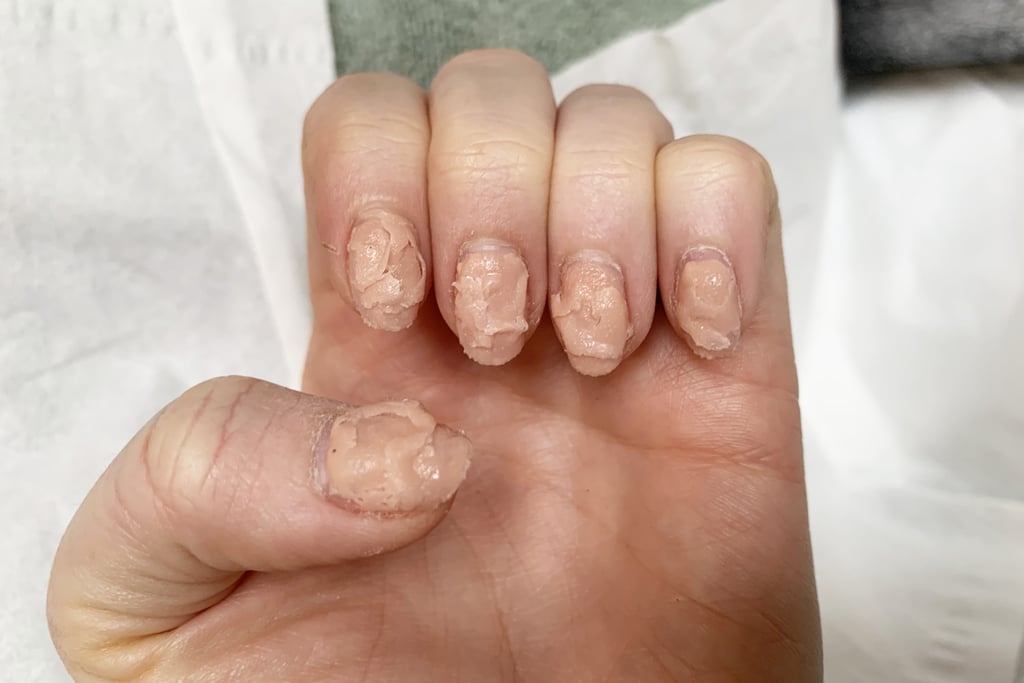 Gel Nails After 2 Coats of Aliver Gel Nail Polish Remover