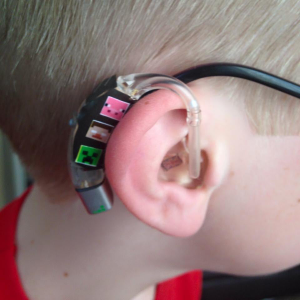 Mom Creates Superhero Hearing Aids For Son