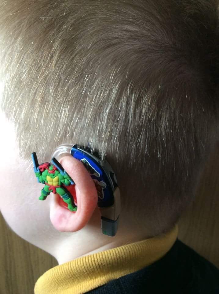 Mom Creates Superhero Hearing Aids For Son