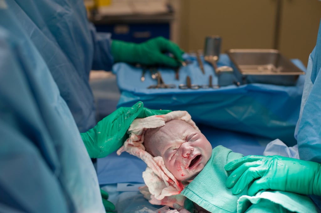 C-Section Birth Story Photo Shoot