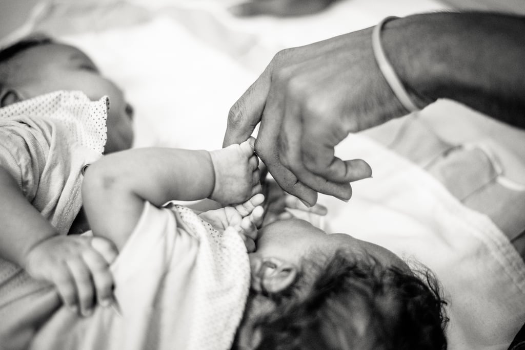 Photographer Captures the Beauty of Conjoined Twins