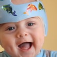 Baby Helmets Are Becoming More Common — but Are They Really Necessary?