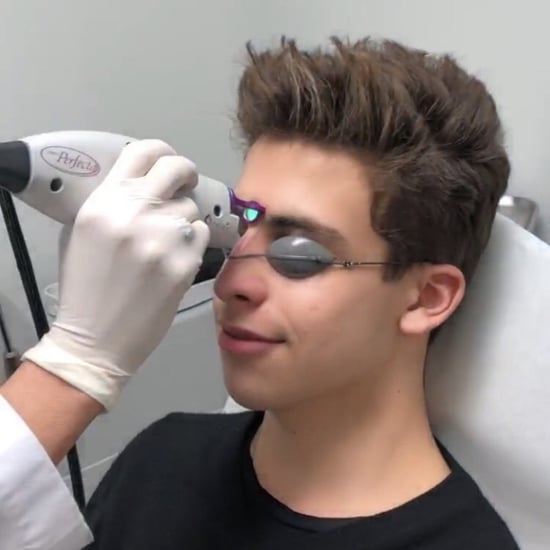 How to Get Rid of Acne With Lasers
